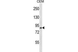 Western Blotting (WB) image for anti-ADAM Metallopeptidase Domain 11 (ADAM11) antibody (ABIN2997715) (ADAM11 anticorps)