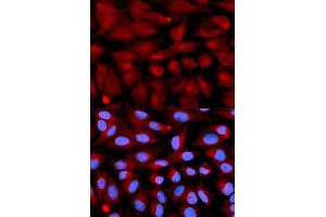 Immunofluorescence analysis of U2OS cell using CD70 antibody. (CD70 anticorps  (AA 39-193))
