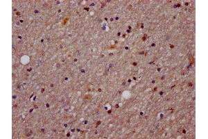 IHC image of ABIN7165091 diluted at 1:1200 and staining in paraffin-embedded human brain tissue performed on a Leica BondTM system.