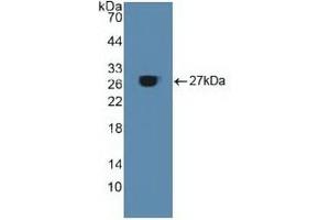 Detection of Recombinant ACO1, Human using Polyclonal Antibody to Aconitase 1 (ACO1) (Aconitase 1 anticorps  (AA 251-443))