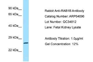 Western Blotting (WB) image for anti-RAB1B, Member RAS Oncogene Family (RAB1B) (C-Term) antibody (ABIN2774390)