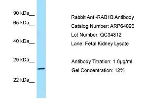 Western Blotting (WB) image for anti-RAB1B, Member RAS Oncogene Family (RAB1B) (C-Term) antibody (ABIN2774390) (RAB1B anticorps  (C-Term))