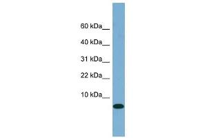 FABP1 antibody used at 1 ug/ml to detect target protein. (FABP1 anticorps  (N-Term))