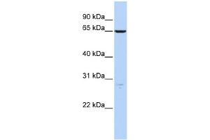 WB Suggested Anti-HAS3 Antibody Titration:  0. (HAS3 anticorps  (N-Term))
