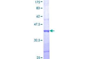 Image no. 1 for Cholinergic Receptor, Nicotinic, alpha 4 (CHRNA4) (AA 29-128) protein (GST tag) (ABIN1349402)