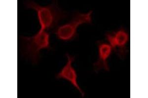 ABIN6266770 staining LOVO by IF/ICC. (ADNP anticorps  (N-Term))