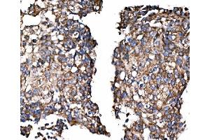 IHC analysis of Paxillin/PXN using anti-Paxillin/PXN antibody (ABIN7602636). (Paxillin anticorps  (AA 9-570))