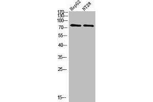 Western Blot analysis of hepg2, NT28 cells using Antibody diluted at 500. (RPS6KA2 anticorps  (AA 330-400))