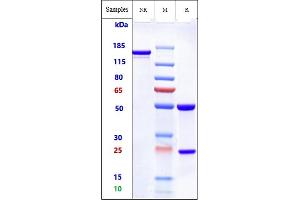 Anti-ROR2 Reference Antibody (Ozuriftamab) on SDS-PAGE under reducing (R) condition. (Recombinant ROR2 (Ozuriftamab Biosimilar) anticorps)