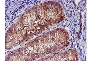 Image no. 7 for anti-Spermine Synthase, SMS (SMS) antibody (ABIN1501093)