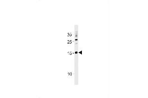 SSNA1 Antibody (N-term) (ABIN1881836 and ABIN2843441) western blot analysis in  cell line lysates (35 μg/lane). (SSNA1 anticorps  (N-Term))