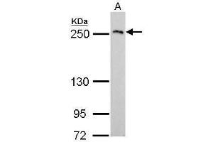 WB Image COL3A1 antibody [C2C3], C-term detects COL3A1 protein by Western blot analysis. (COL3A1 anticorps  (C-Term))