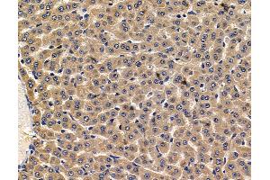 ABIN7096932 and ABIN7100998 at 1/100 staining rat liver tissue by IHC-P.