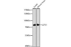 Western blot analysis of extracts of various cell lines, using LZTS1 antibody (ABIN7268226) at 1:3000 dilution.