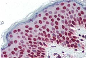 Human Skin (formalin-fixed, paraffin-embedded) stained with SETD7 antibody ABIN364315 at 5 ug/ml followed by biotinylated anti-mouse IgG secondary antibody ABIN481714, alkaline phosphatase-streptavidin and chromogen. (SETD7 anticorps)