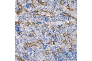 Immunohistochemistry of paraffin-embedded rat spleen using eNOS Rabbit mAb (ABIN7268920) at dilution of 1:200 (40x lens).