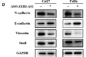 ZEB2-AS1 knockdown inhibits migration, invasion and EMT in HNSCC cells. (Vimentin anticorps)
