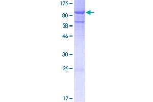 Image no. 1 for Oral-Facial-Digital Syndrome 1 (OFD1) (AA 1-550) protein (GST tag) (ABIN1313344)