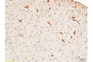 Formalin-fixed and paraffin embedded rat brainstem with Anti-Fascin1 Polyclonal Antibody, Unconjugated  at 1:300, followed by conjugation to the secondary antibody and DAB staining