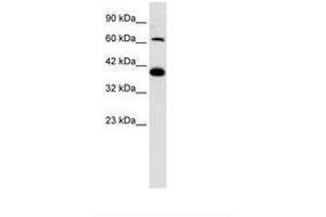 Image no. 2 for anti-Glutamate Receptor, Ionotropic, Kainate 2 (GRIK2) (AA 151-200) antibody (ABIN202320) (GRIK2 anticorps  (AA 151-200))