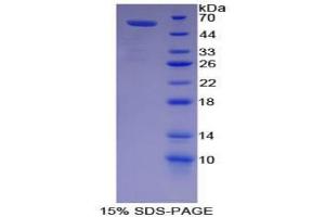 SDS-PAGE analysis of Pig Lipase, Hepatic Protein. (LIPC Protéine)