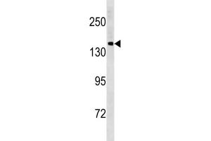 Western Blotting (WB) image for anti-Protocadherin 11 Y-Linked (PCDH11Y) antibody (ABIN3004496) (PCDH11Y anticorps)