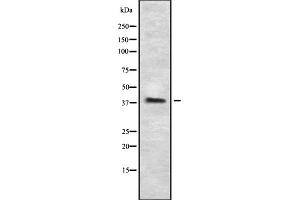 Western blot analysis of P2RY5 using HeLa whole cell lysates