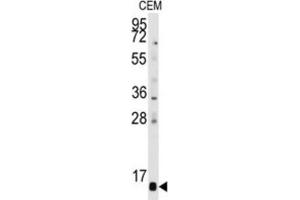 Western Blotting (WB) image for anti-Prefoldin Subunit 6 (PFDN6) antibody (ABIN3001660) (PFDN6 anticorps)