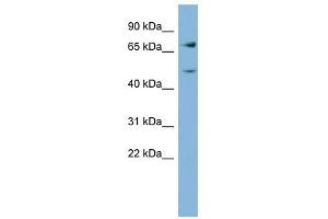 GFPT2 antibody used at 1 ug/ml to detect target protein.