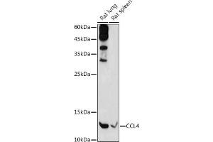 Western blot analysis of extracts of various cell lines, using CCL4 antibody (ABIN3022366, ABIN3022367, ABIN3022368 and ABIN6218763) at 1:1000 dilution. (CCL4 anticorps  (C-Term))