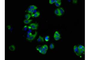 Immunofluorescence staining of MCF-7 cells with ABIN7166124 at 1:66, counter-stained with DAPI. (SHROOM2 anticorps  (AA 213-405))