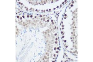 Immunohistochemistry of paraffin-embedded mouse testis using GA Rabbit pAb (ABIN3022563, ABIN3022564, ABIN3022565, ABIN1679943 and ABIN6218905) at dilution of 1:200 (40x lens). (GADD45A anticorps  (AA 1-165))