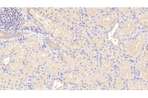 Detection of STC1 in Human Kidney Tissue using Polyclonal Antibody to Stanniocalcin 1 (STC1)