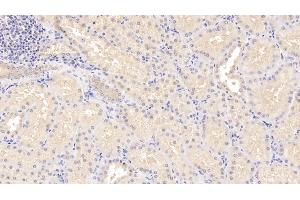 Detection of STC1 in Human Kidney Tissue using Polyclonal Antibody to Stanniocalcin 1 (STC1) (Stanniocalcin 1 anticorps  (AA 28-247))