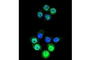 Confocal immunofluorescent analysis of AKR1B1 Antibody (C-term) (ABIN389205 and ABIN2839363) with 293 cell followed by Alexa Fluor 488-conjugated goat anti-rabbit lgG (green). (AKR1B1 anticorps  (C-Term))