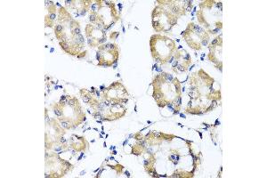 Immunohistochemistry of paraffin-embedded human gastric using RBP2 antibody at dilution of 1:100 (x40 lens). (RBP2 anticorps)