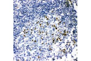 Anti-MUM1 antibody, (ABIN3042469), IHC(P)IHC(P): Human Tonsil Tissue