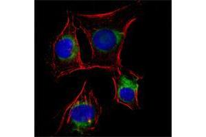 Immunofluorescence analysis of EC cells using NGFR mouse mAb (green). (NGFR anticorps)