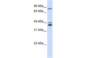 C18ORF10 antibody used at 1 ug/ml to detect target protein. (TPGS2 anticorps  (Middle Region))