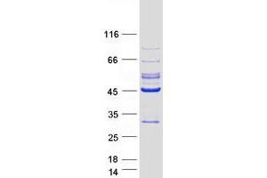 Validation with Western Blot