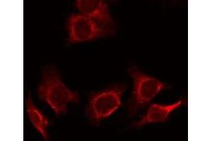 ABIN6278359 staining SW480 cells by ICC/IF. (MUC2 anticorps)