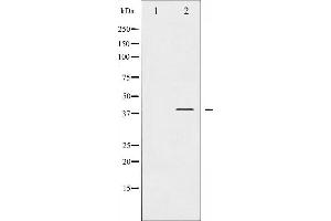 Western blot analysis of I kappaB- alpha phosphorylation expression in nocodazole treated COS7 whole cell lysates,The lane on the left is treated with the antigen-specific peptide.