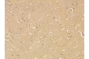 MAP2 Mouse Monoclonal Antibody at 1/100 staining mouse brain tissue by IHC-P. (MAP2 anticorps  (C-Term))