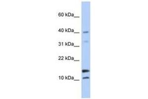 Image no. 1 for anti-WAP Four-Disulfide Core Domain 5 (WFDC5) (N-Term) antibody (ABIN6743675) (WFDC5 anticorps  (N-Term))
