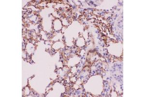 Anti-ACE Picoband antibody,  IHC(P): Mouse Lung Tissue