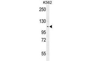 ANKRD18B Antibody (N-term) western blot analysis in K562 cell line lysates (35µg/lane). (ANKRD18B anticorps  (N-Term))
