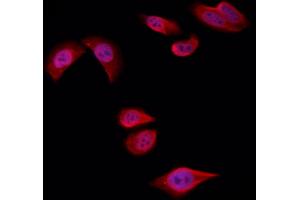 ABIN6258722 and ABIN6274757 staining Hela by IF/ICC. (RPS4Y1 anticorps  (C-Term))