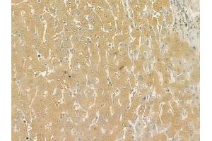 ABIN6265505 and ABIN6276977 at 1/100 staining human normal liver tissue by IHC-P.