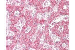 Anti-SIN1 antibody IHC of human liver.