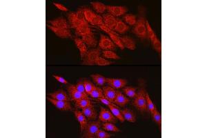 Immunofluorescence analysis of PC-12 cells using CPT2 Rabbit pAb (ABIN6129249, ABIN6138983, ABIN6138984 and ABIN6216045) at dilution of 1:100 (40x lens).